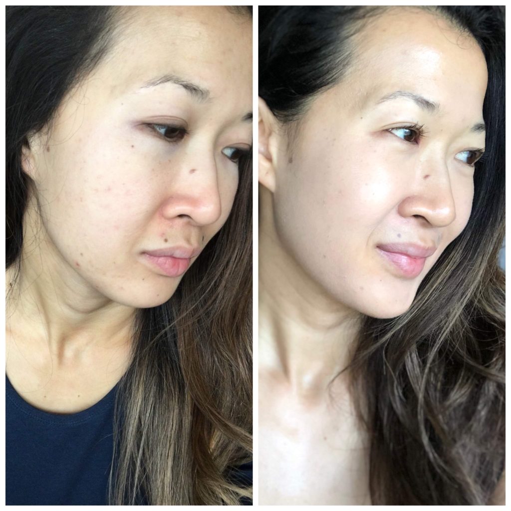 How ZO Skin Health Changed My Skin In 28 Days A Beautiful RAWR